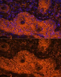 Anti-Tyrosinase antibody used in IHC (Paraffin sections) (IHC-P). GTX16389