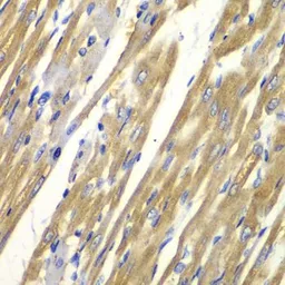 Anti-Tyrosinase antibody used in IHC (Paraffin sections) (IHC-P). GTX16389