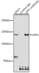 Anti-RENT1 antibody used in Immunoprecipitation (IP). GTX16390
