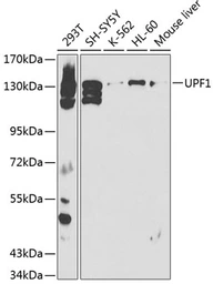 Anti-RENT1 antibody used in Western Blot (WB). GTX16390