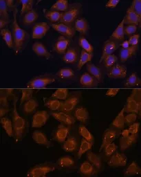 Anti-RENT1 antibody used in Immunocytochemistry/ Immunofluorescence (ICC/IF). GTX16390