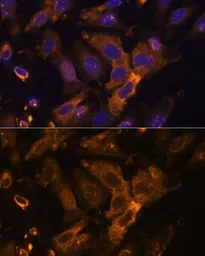 Anti-TIMP2 antibody used in Immunocytochemistry/ Immunofluorescence (ICC/IF). GTX16392