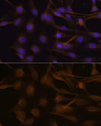 Anti-TIMP2 antibody used in Immunocytochemistry/ Immunofluorescence (ICC/IF). GTX16392
