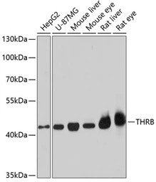Anti-Thyroid Hormone Receptor beta antibody used in Western Blot (WB). GTX16393