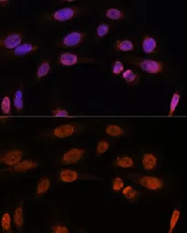 Anti-Thyroid Hormone Receptor beta antibody used in Immunocytochemistry/ Immunofluorescence (ICC/IF). GTX16393