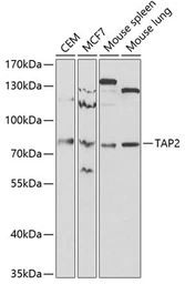 Anti-TAP2 antibody used in Western Blot (WB). GTX16394