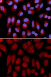Anti-TAP2 antibody used in Immunocytochemistry/ Immunofluorescence (ICC/IF). GTX16394