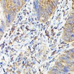 Anti-TAP2 antibody used in IHC (Paraffin sections) (IHC-P). GTX16394
