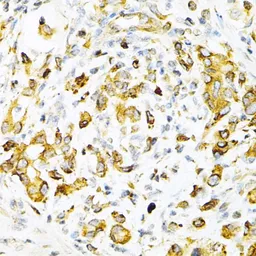 Anti-Tapasin antibody used in IHC (Paraffin sections) (IHC-P). GTX16401