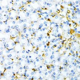 Anti-Tapasin antibody used in IHC (Paraffin sections) (IHC-P). GTX16401