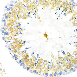 Anti-Tapasin antibody used in IHC (Paraffin sections) (IHC-P). GTX16401