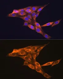 Anti-VEGFB antibody used in Immunocytochemistry/ Immunofluorescence (ICC/IF). GTX16404