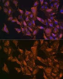 Anti-VEGFB antibody used in Immunocytochemistry/ Immunofluorescence (ICC/IF). GTX16404