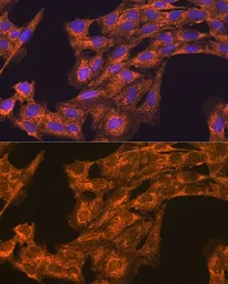 Anti-VEGFB antibody used in Immunocytochemistry/ Immunofluorescence (ICC/IF). GTX16404