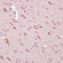 Anti-Tollip antibody used in IHC (Paraffin sections) (IHC-P). GTX16406
