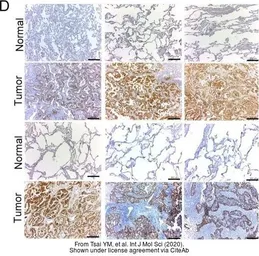 Anti-TTK antibody used in Immunohistochemistry (IHC). GTX16407