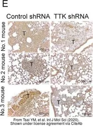 Anti-TTK antibody used in Immunohistochemistry (IHC). GTX16407