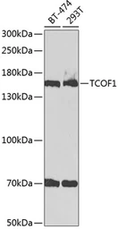 Anti-TCOF1 antibody used in Western Blot (WB). GTX16408