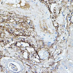 Anti-TGFBI antibody used in IHC (Paraffin sections) (IHC-P). GTX16415