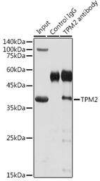 Anti-Tropomyosin 2 antibody used in Immunoprecipitation (IP). GTX16425