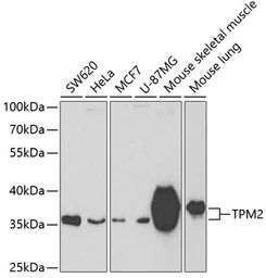 Anti-Tropomyosin 2 antibody used in Western Blot (WB). GTX16425