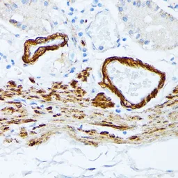Anti-Tropomyosin 2 antibody used in IHC (Paraffin sections) (IHC-P). GTX16425
