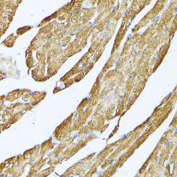 Anti-Tropomyosin 2 antibody used in IHC (Paraffin sections) (IHC-P). GTX16425