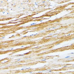 Anti-Tropomyosin 2 antibody used in IHC (Paraffin sections) (IHC-P). GTX16425