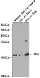 Anti-Urotensin II antibody used in Western Blot (WB). GTX16426