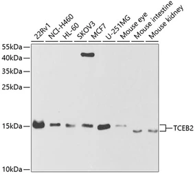 Anti-Elongin B antibody used in Western Blot (WB). GTX16427