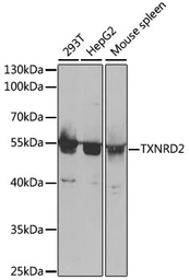 Anti-TXNRD2 antibody used in Western Blot (WB). GTX16430