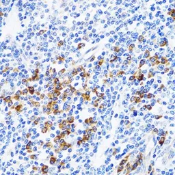 Anti-TWEAK antibody used in IHC (Paraffin sections) (IHC-P). GTX16436