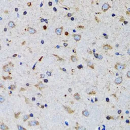 Anti-TWEAK antibody used in IHC (Paraffin sections) (IHC-P). GTX16436