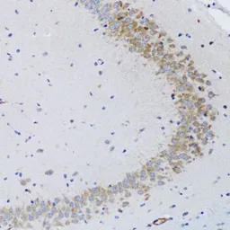 Anti-TWEAK antibody used in IHC (Paraffin sections) (IHC-P). GTX16436
