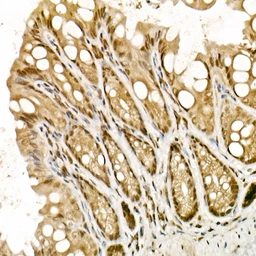 Anti-TOPBP1 antibody used in IHC (Paraffin sections) (IHC-P). GTX16438