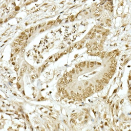 Anti-TOPBP1 antibody used in IHC (Paraffin sections) (IHC-P). GTX16438