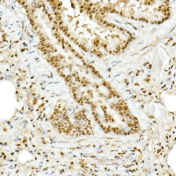 Anti-TOPBP1 antibody used in IHC (Paraffin sections) (IHC-P). GTX16438