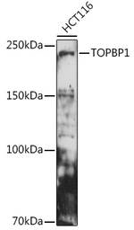 Anti-TOPBP1 antibody used in Western Blot (WB). GTX16438