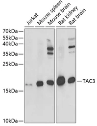 Anti-Neurokinin B antibody used in Western Blot (WB). GTX16441
