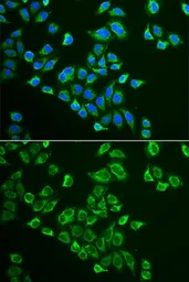 Anti-Neurokinin B antibody used in Immunocytochemistry/ Immunofluorescence (ICC/IF). GTX16441