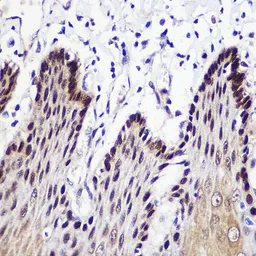 Anti-Transketolase antibody used in IHC (Paraffin sections) (IHC-P). GTX16442