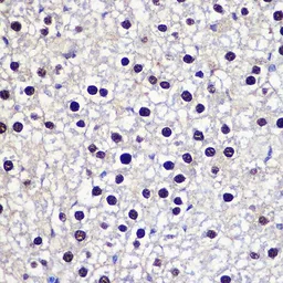 Anti-Transketolase antibody used in IHC (Paraffin sections) (IHC-P). GTX16442