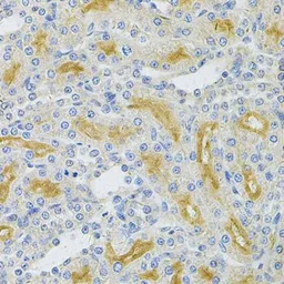 Anti-UBE2B antibody used in IHC (Paraffin sections) (IHC-P). GTX16443