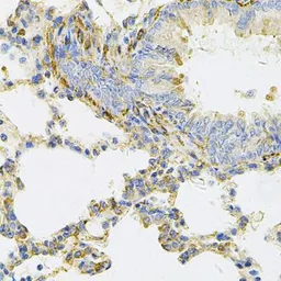 Anti-UBE2B antibody used in IHC (Paraffin sections) (IHC-P). GTX16443
