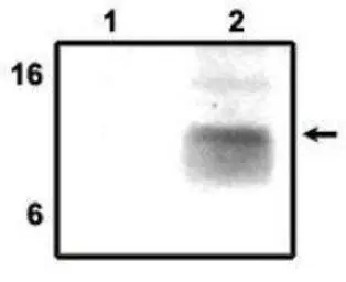 Anti-DAP12 antibody used in Immunoprecipitation (IP). GTX16462