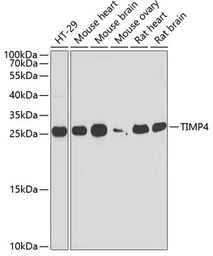 Anti-TIMP4 antibody used in Western Blot (WB). GTX16463