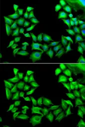 Anti-TIMP4 antibody used in Immunocytochemistry/ Immunofluorescence (ICC/IF). GTX16463