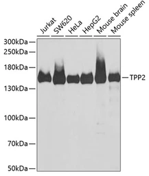 Anti-Tripeptidyl peptidase II antibody used in Western Blot (WB). GTX16466