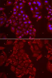 Anti-Tripeptidyl peptidase II antibody used in Immunocytochemistry/ Immunofluorescence (ICC/IF). GTX16466