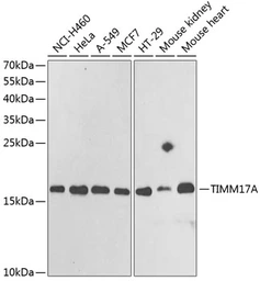 Anti-TIM17 antibody used in Western Blot (WB). GTX16468